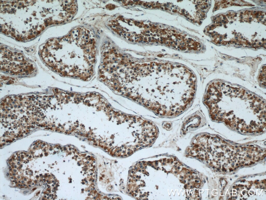 Immunohistochemistry (IHC) staining of human testis tissue using PPP2R2C Polyclonal antibody (12747-1-AP)