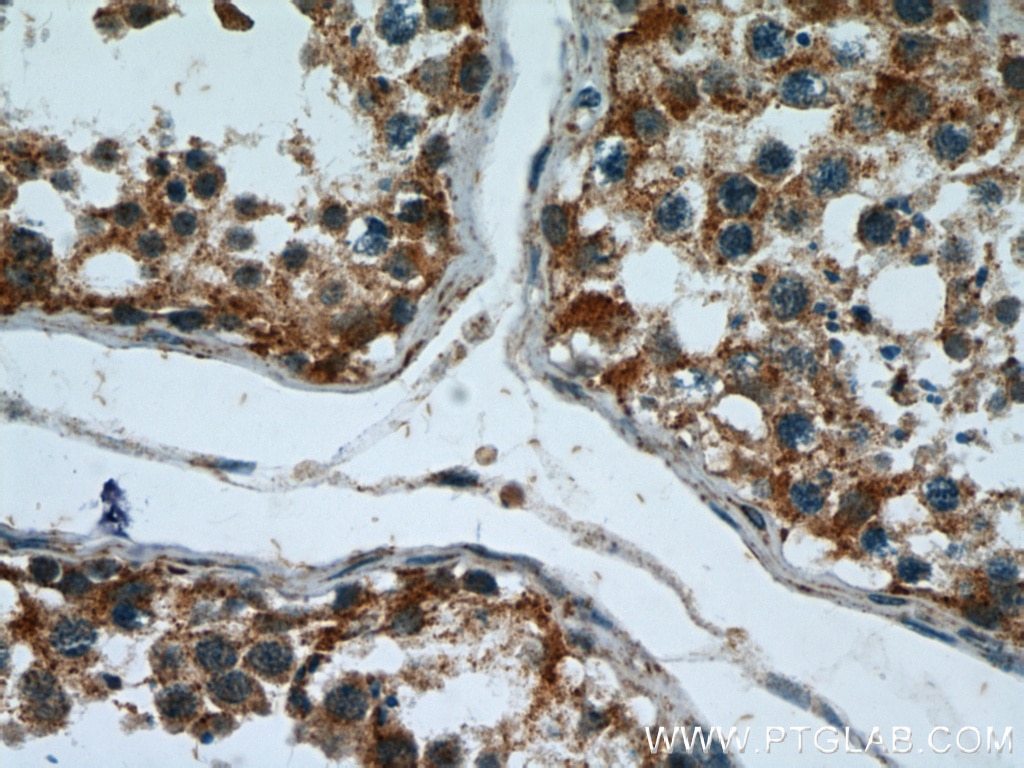 Immunohistochemistry (IHC) staining of human testis tissue using PPP2R2C Polyclonal antibody (12747-1-AP)