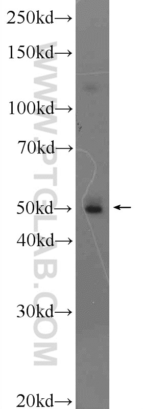 Western Blot (WB) analysis of HeLa cells using PPP2R2C Polyclonal antibody (12747-1-AP)