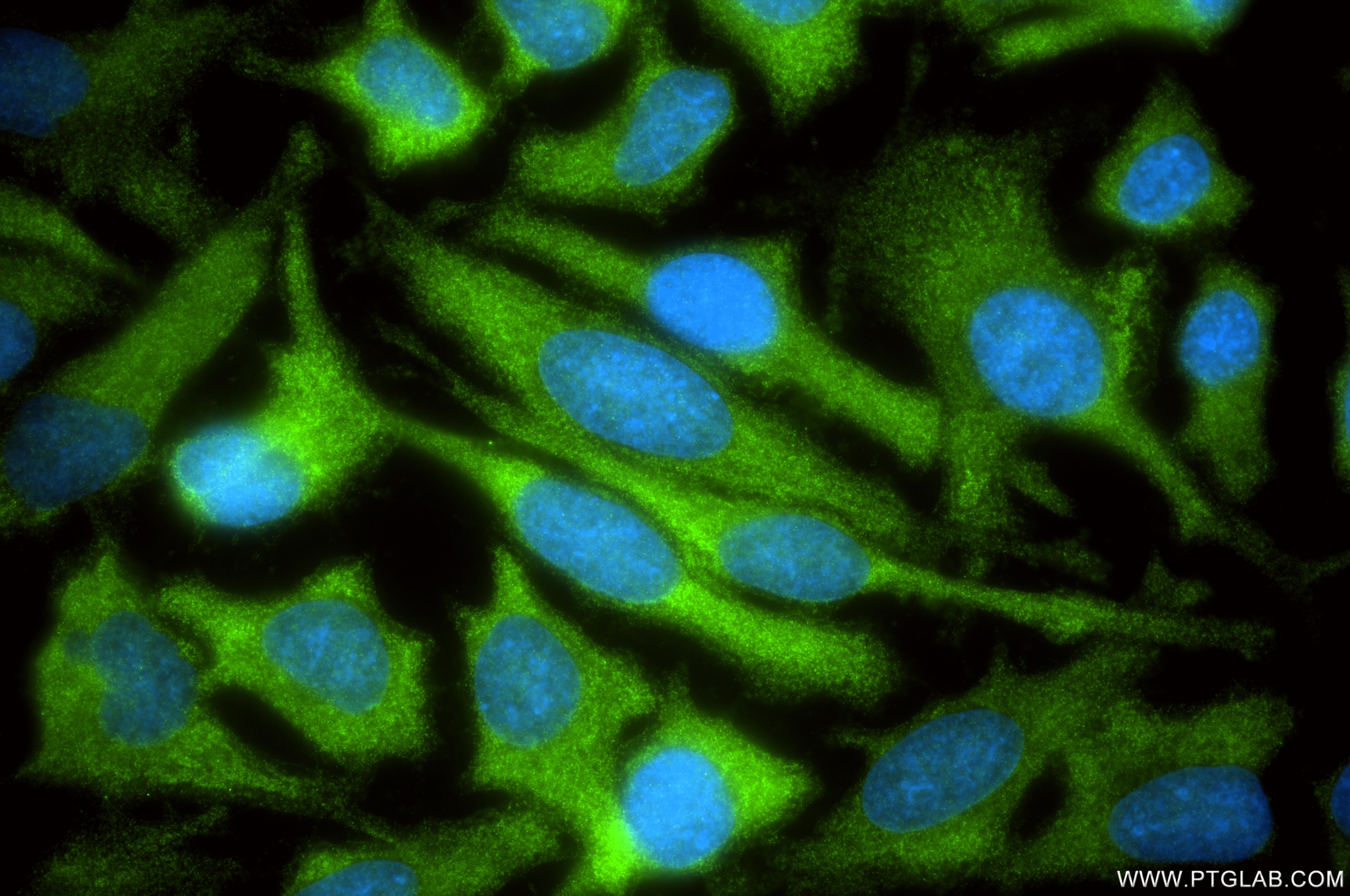 Immunofluorescence (IF) / fluorescent staining of HeLa cells using PPP2R2C Recombinant monoclonal antibody (86383-1-RR)