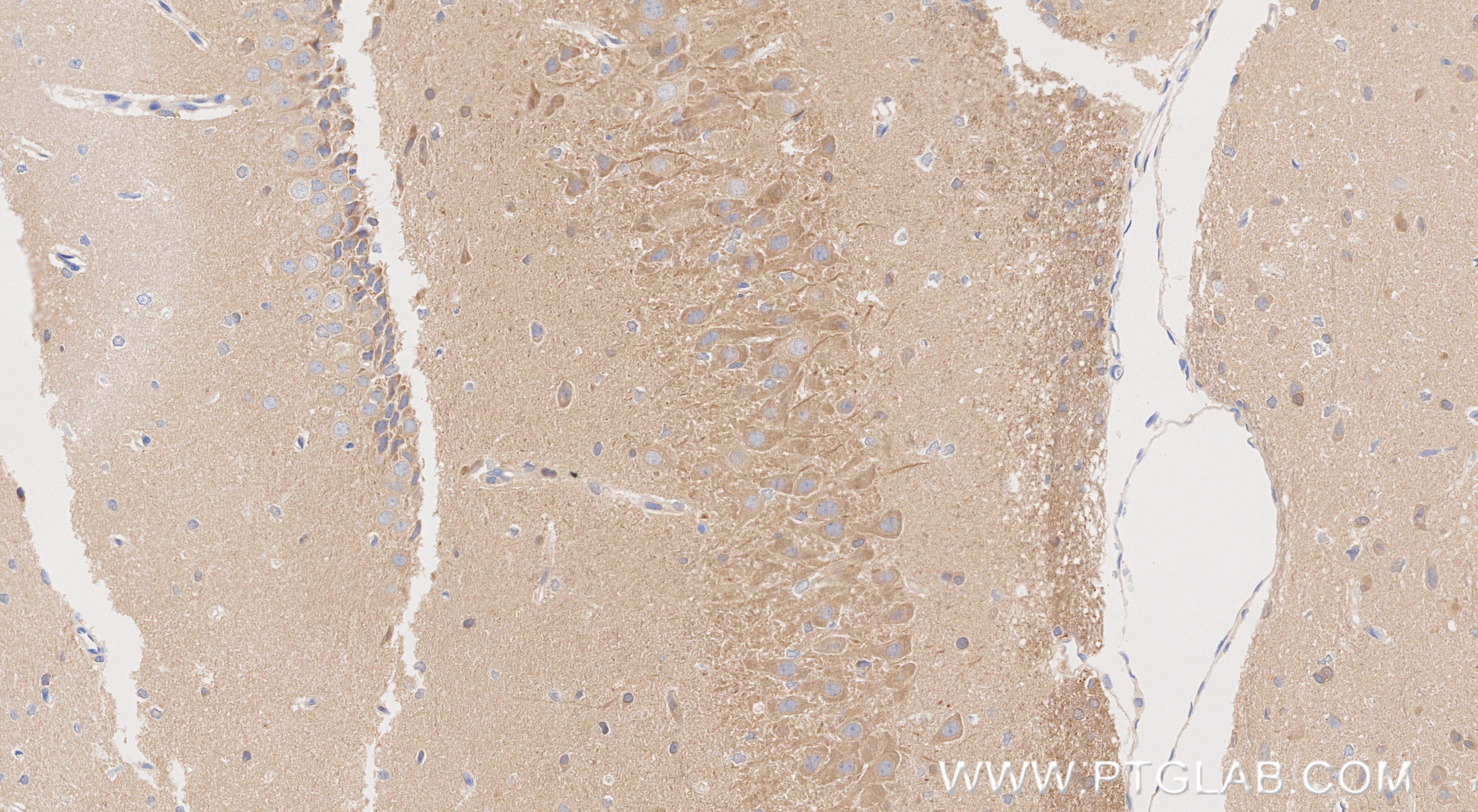 Immunohistochemistry (IHC) staining of rat brain tissue using PPP2R2C Recombinant monoclonal antibody (86383-1-RR)