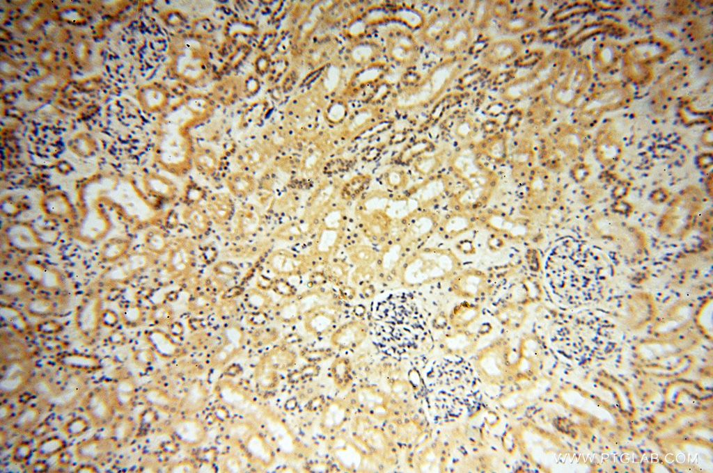 Immunohistochemistry (IHC) staining of human kidney tissue using PPP2R3A Polyclonal antibody (14720-1-AP)