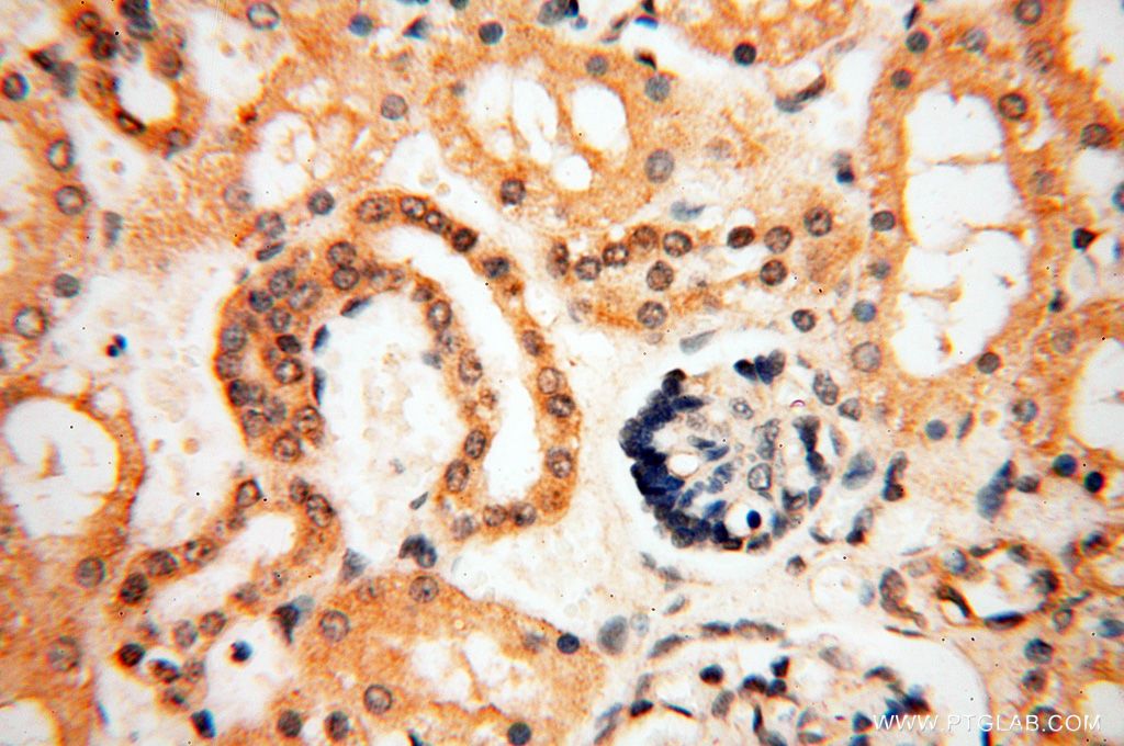 Immunohistochemistry (IHC) staining of human kidney tissue using PPP2R3A Polyclonal antibody (14720-1-AP)