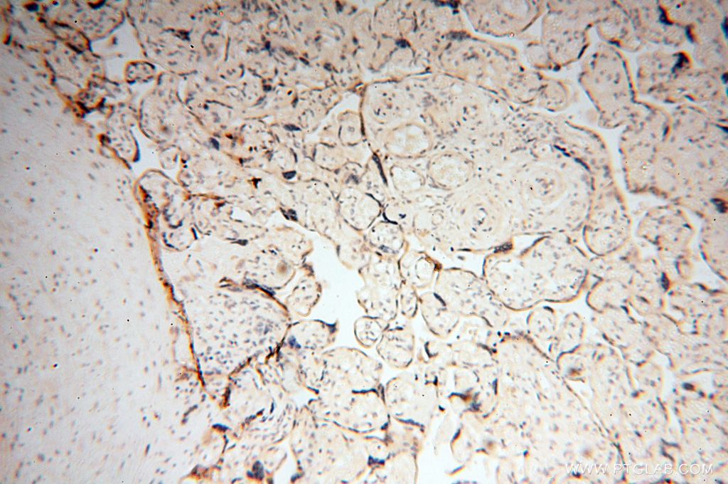 Immunohistochemistry (IHC) staining of human placenta tissue using PPP2R3A Polyclonal antibody (14720-1-AP)
