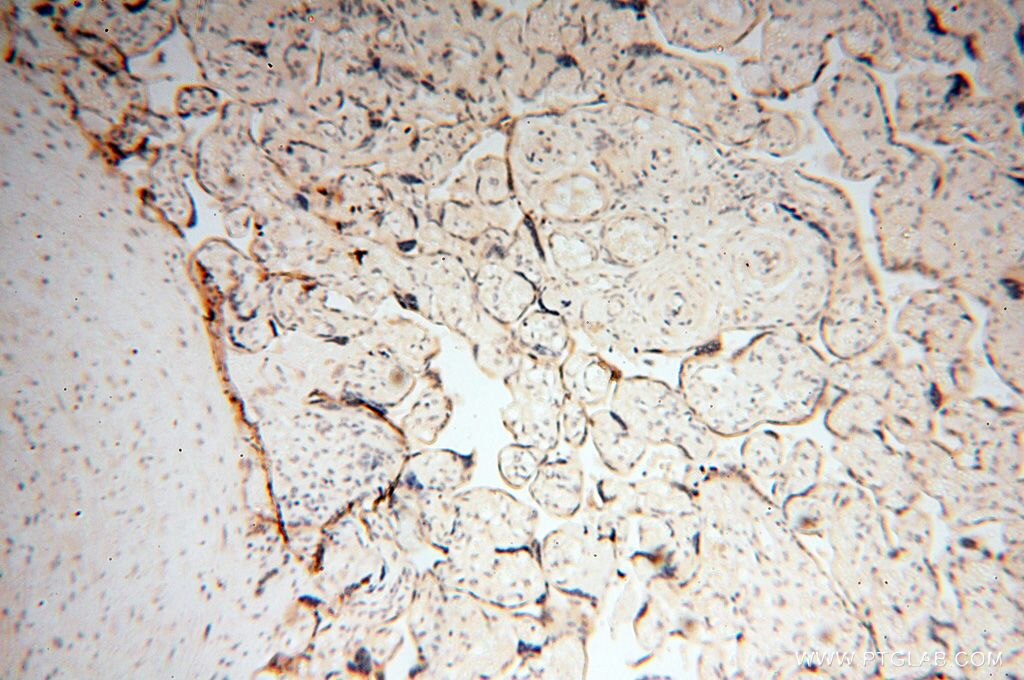 Immunohistochemistry (IHC) staining of human placenta tissue using PPP2R3A Polyclonal antibody (14720-1-AP)