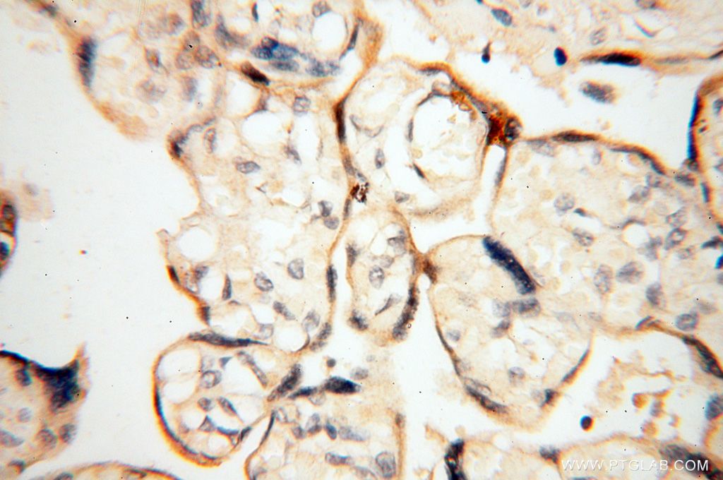 Immunohistochemistry (IHC) staining of human placenta tissue using PPP2R3A Polyclonal antibody (14720-1-AP)
