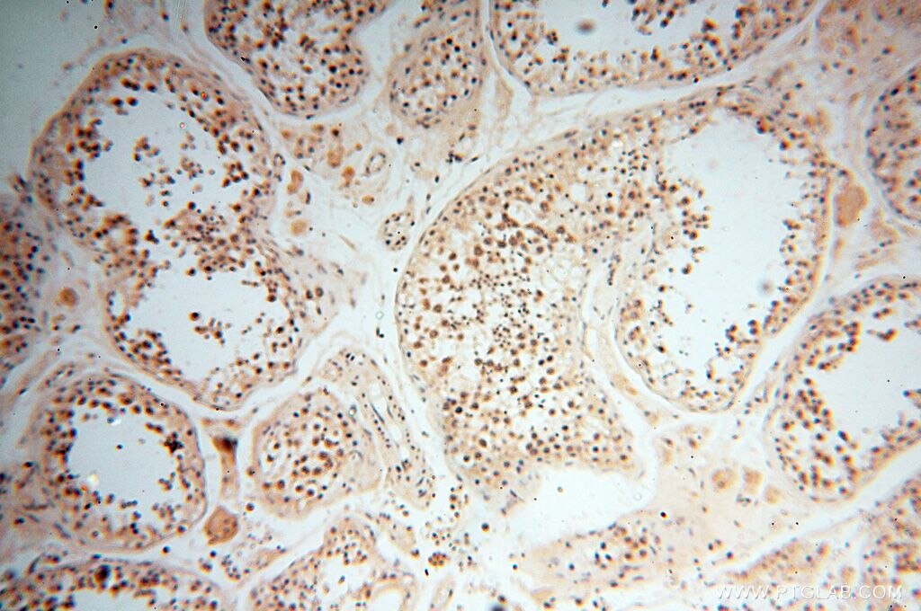 Immunohistochemistry (IHC) staining of human testis tissue using PPP2R3A Polyclonal antibody (14720-1-AP)