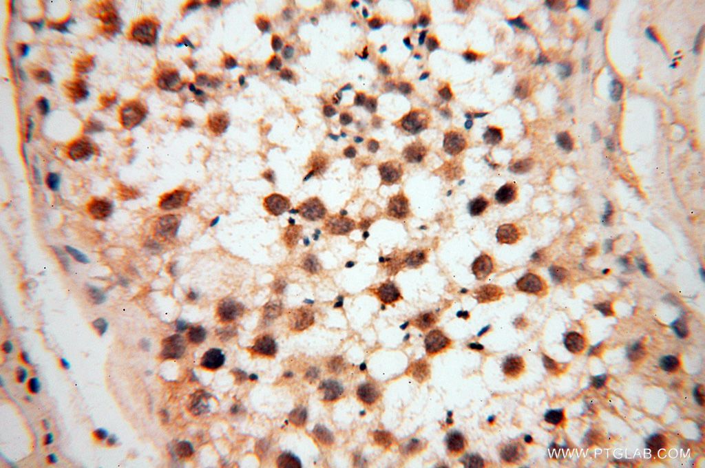 Immunohistochemistry (IHC) staining of human testis tissue using PPP2R3A Polyclonal antibody (14720-1-AP)