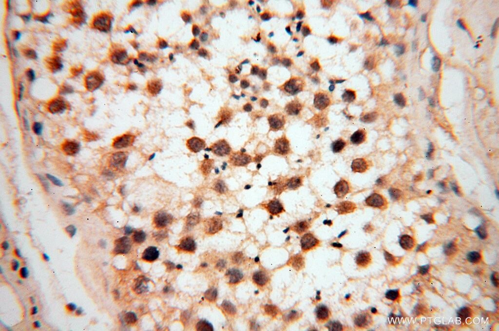 IHC staining of human testis using 14720-1-AP