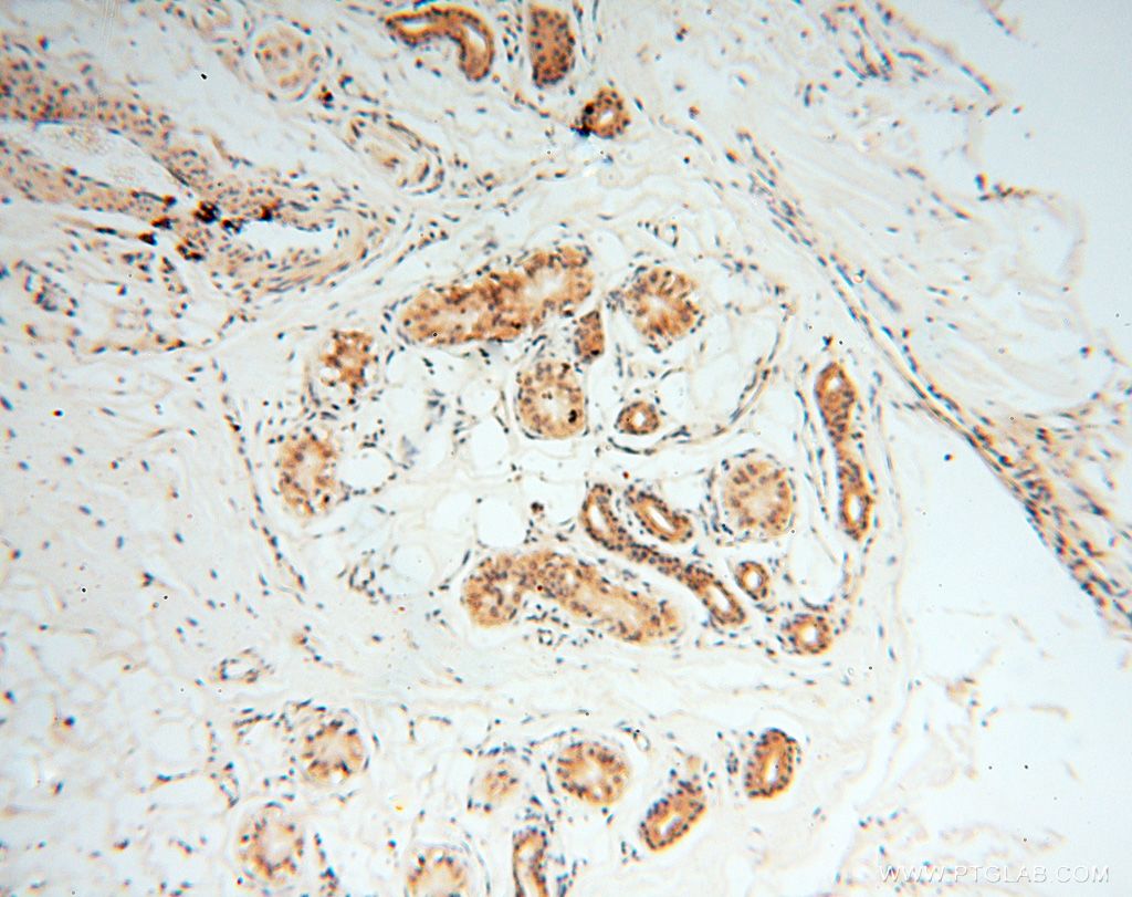 Immunohistochemistry (IHC) staining of human skin tissue using PPP2R3A Polyclonal antibody (14720-1-AP)