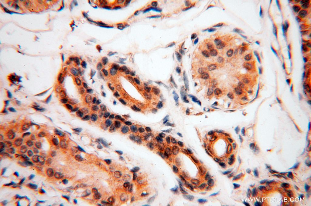 Immunohistochemistry (IHC) staining of human skin tissue using PPP2R3A Polyclonal antibody (14720-1-AP)