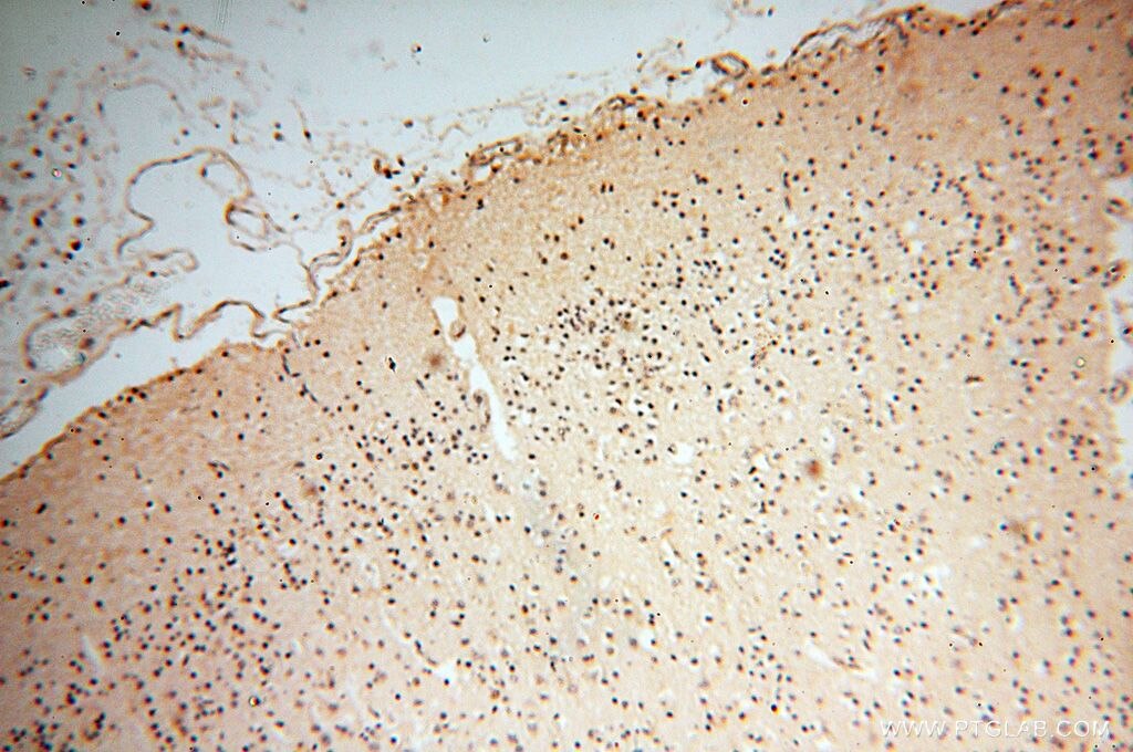 Immunohistochemistry (IHC) staining of human brain tissue using PPP2R3A Polyclonal antibody (14720-1-AP)