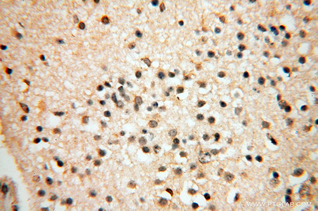 Immunohistochemistry (IHC) staining of human brain tissue using PPP2R3A Polyclonal antibody (14720-1-AP)