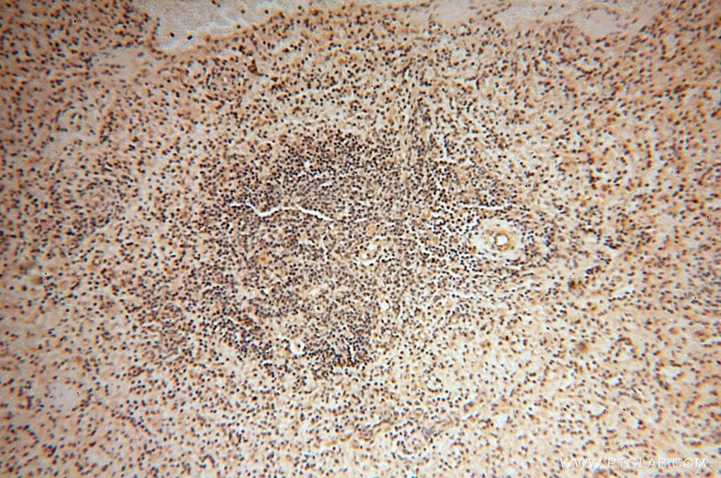 Immunohistochemistry (IHC) staining of human spleen tissue using PPP2R3A Polyclonal antibody (14720-1-AP)