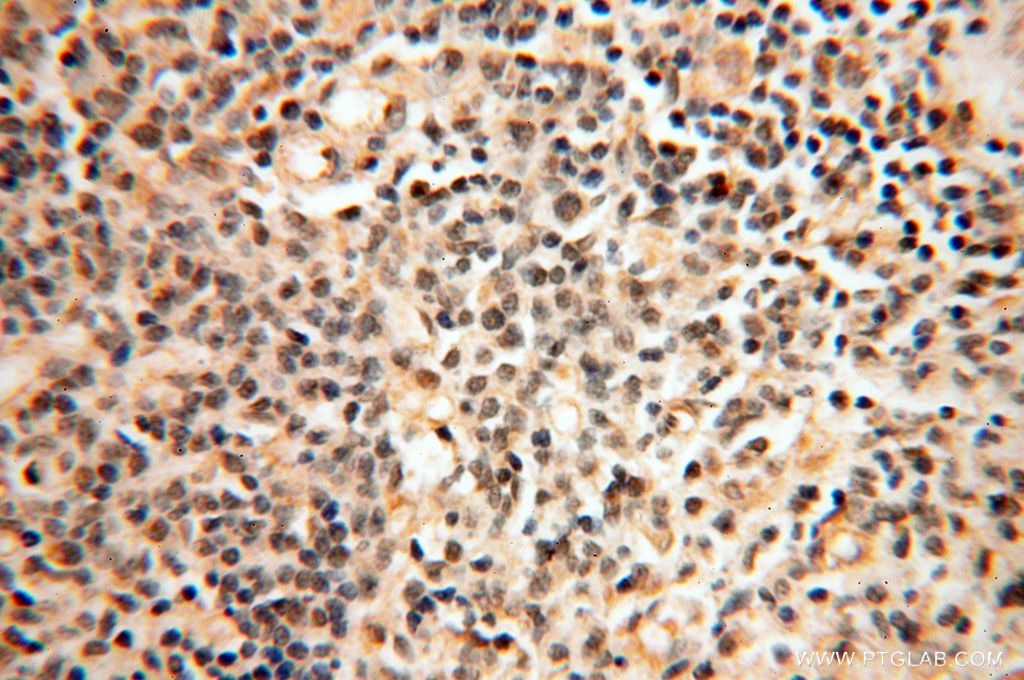 Immunohistochemistry (IHC) staining of human spleen tissue using PPP2R3A Polyclonal antibody (14720-1-AP)