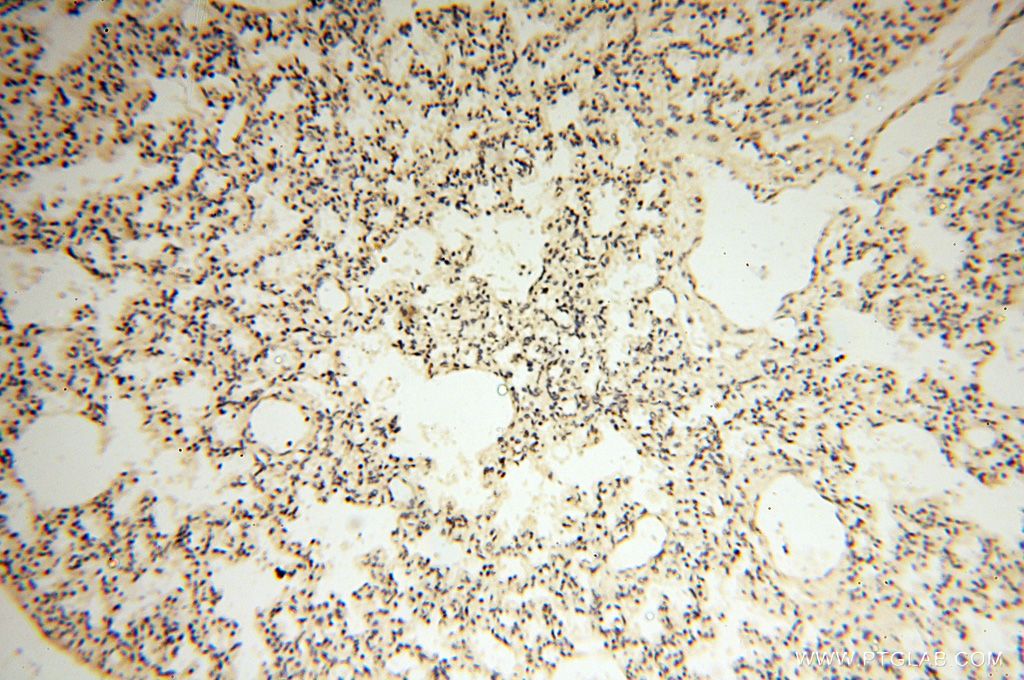 Immunohistochemistry (IHC) staining of human lung tissue using PPP2R3A Polyclonal antibody (14720-1-AP)