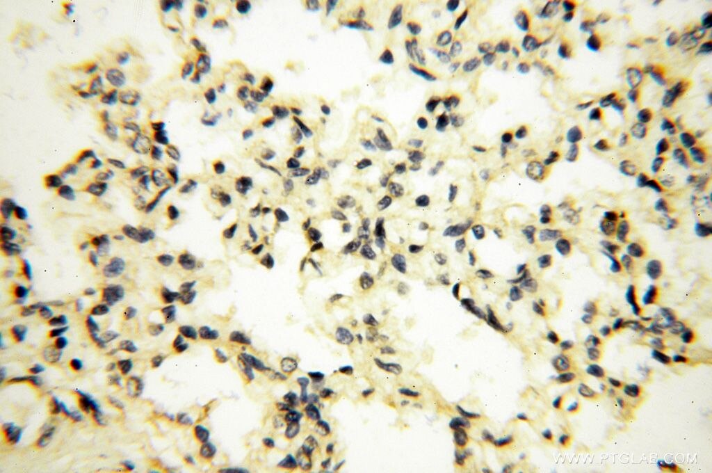 Immunohistochemistry (IHC) staining of human lung tissue using PPP2R3A Polyclonal antibody (14720-1-AP)