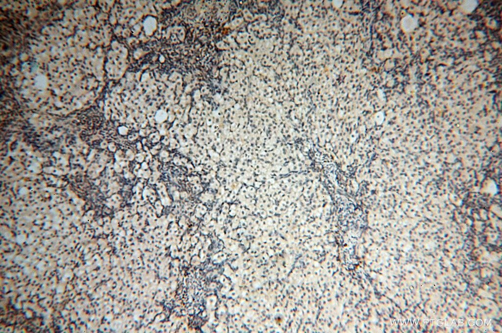 Immunohistochemistry (IHC) staining of human ovary tissue using PPP2R3A Polyclonal antibody (14720-1-AP)