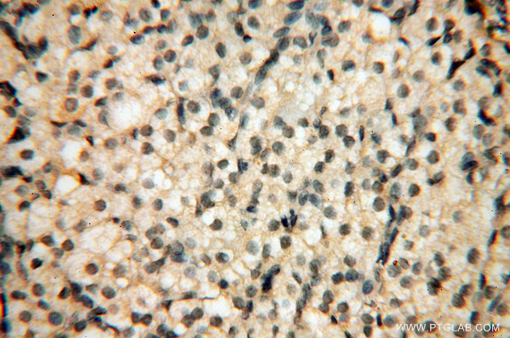Immunohistochemistry (IHC) staining of human ovary tissue using PPP2R3A Polyclonal antibody (14720-1-AP)