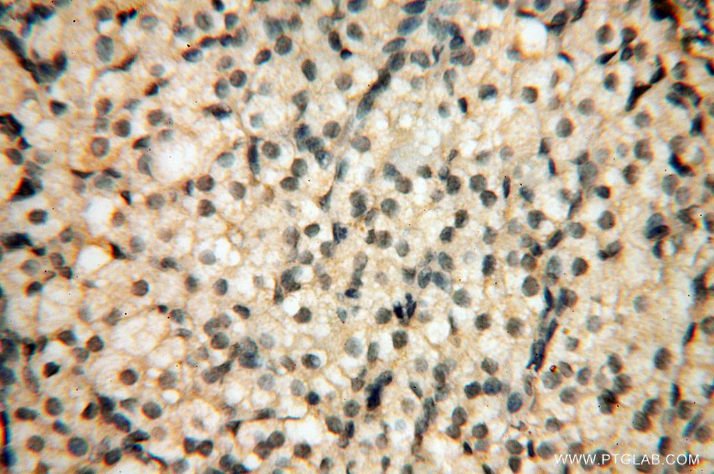 IHC staining of human ovary using 14720-1-AP