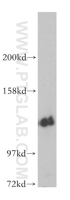 Western Blot (WB) analysis of PC-3 cells using PPP2R3A Polyclonal antibody (14720-1-AP)