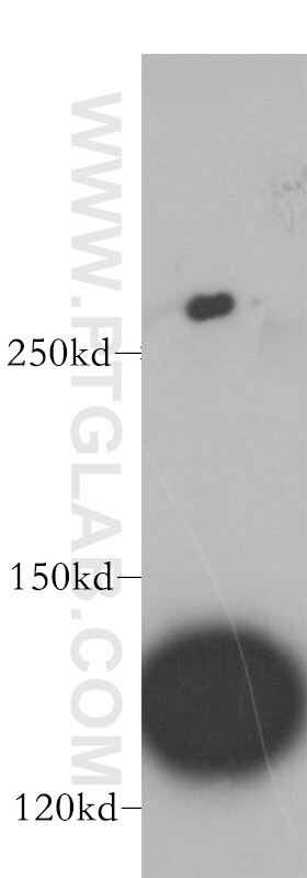 WB analysis of MCF-7 using 14720-1-AP