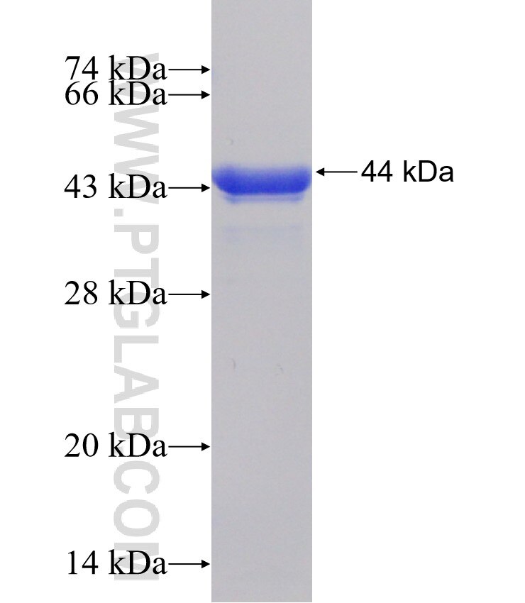 PPP2R3A fusion protein Ag31511 SDS-PAGE