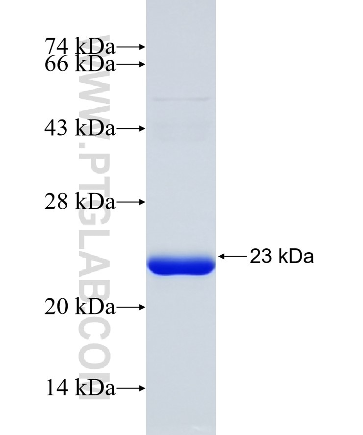 PPP2R3A fusion protein Ag31522 SDS-PAGE PPP2R3A fusion protein Ag31522 SDS-PAGE