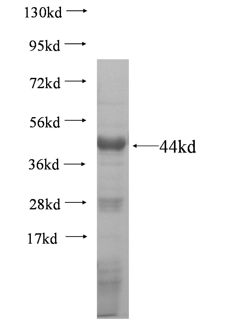 PPP2R3A fusion protein Ag6358 SDS-PAGE