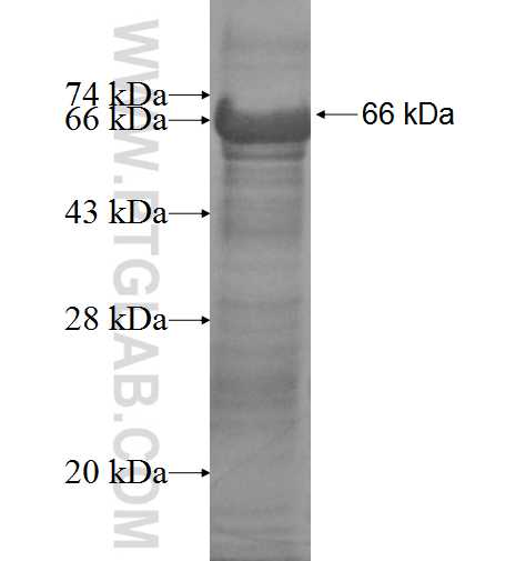 PPP2R3A fusion protein Ag6450 SDS-PAGE
