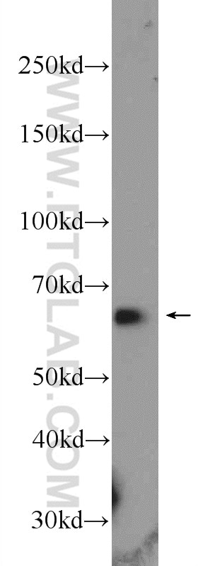 Western Blot (WB) analysis of HeLa cells using PPP2R3B Polyclonal antibody (24502-1-AP)