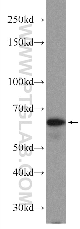 Western Blot (WB) analysis of HL-60 cells using PPP2R3B Polyclonal antibody (24502-1-AP)