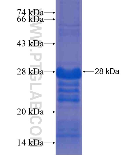 PPP2R3B fusion protein Ag21366 SDS-PAGE