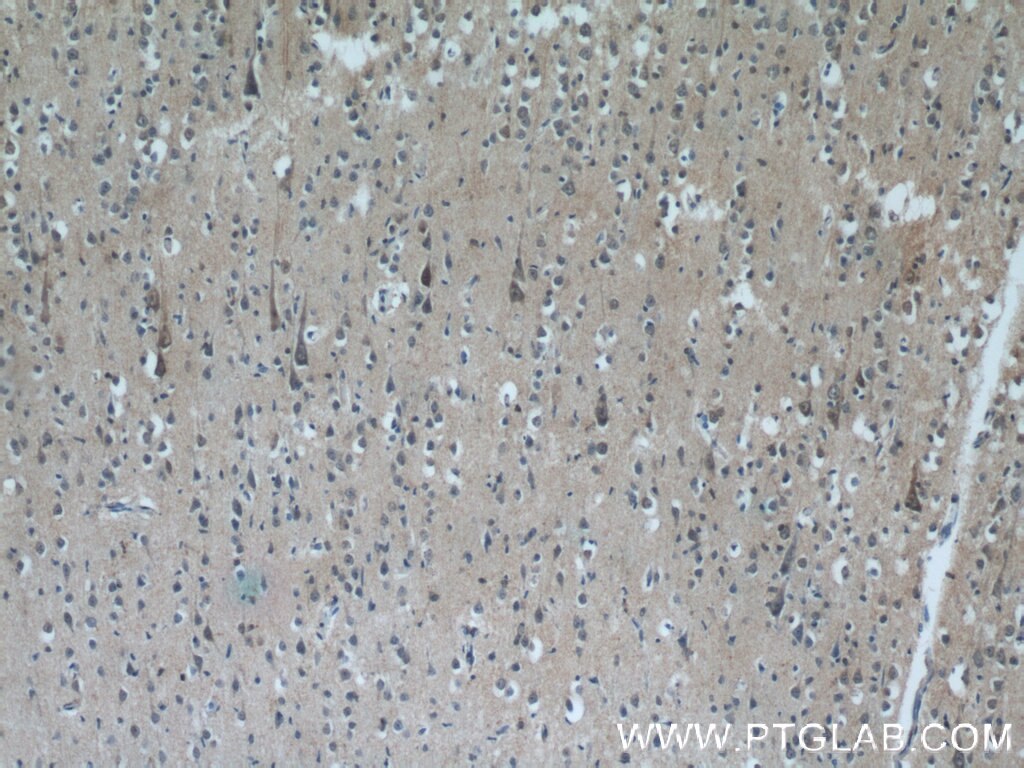 Immunohistochemistry (IHC) staining of human brain tissue using PPP2R3C Polyclonal antibody (24877-1-AP)