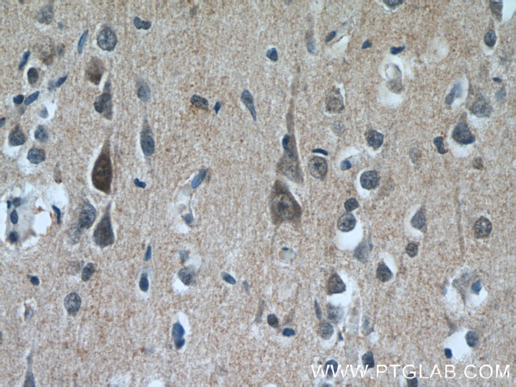 Immunohistochemistry (IHC) staining of human brain tissue using PPP2R3C Polyclonal antibody (24877-1-AP)