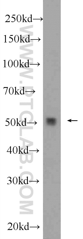 Western Blot (WB) analysis of mouse brain tissue using PPP2R3C Polyclonal antibody (24877-1-AP)