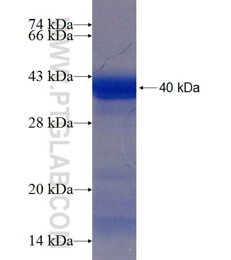 PPP2R3C fusion protein Ag19282 SDS-PAGE