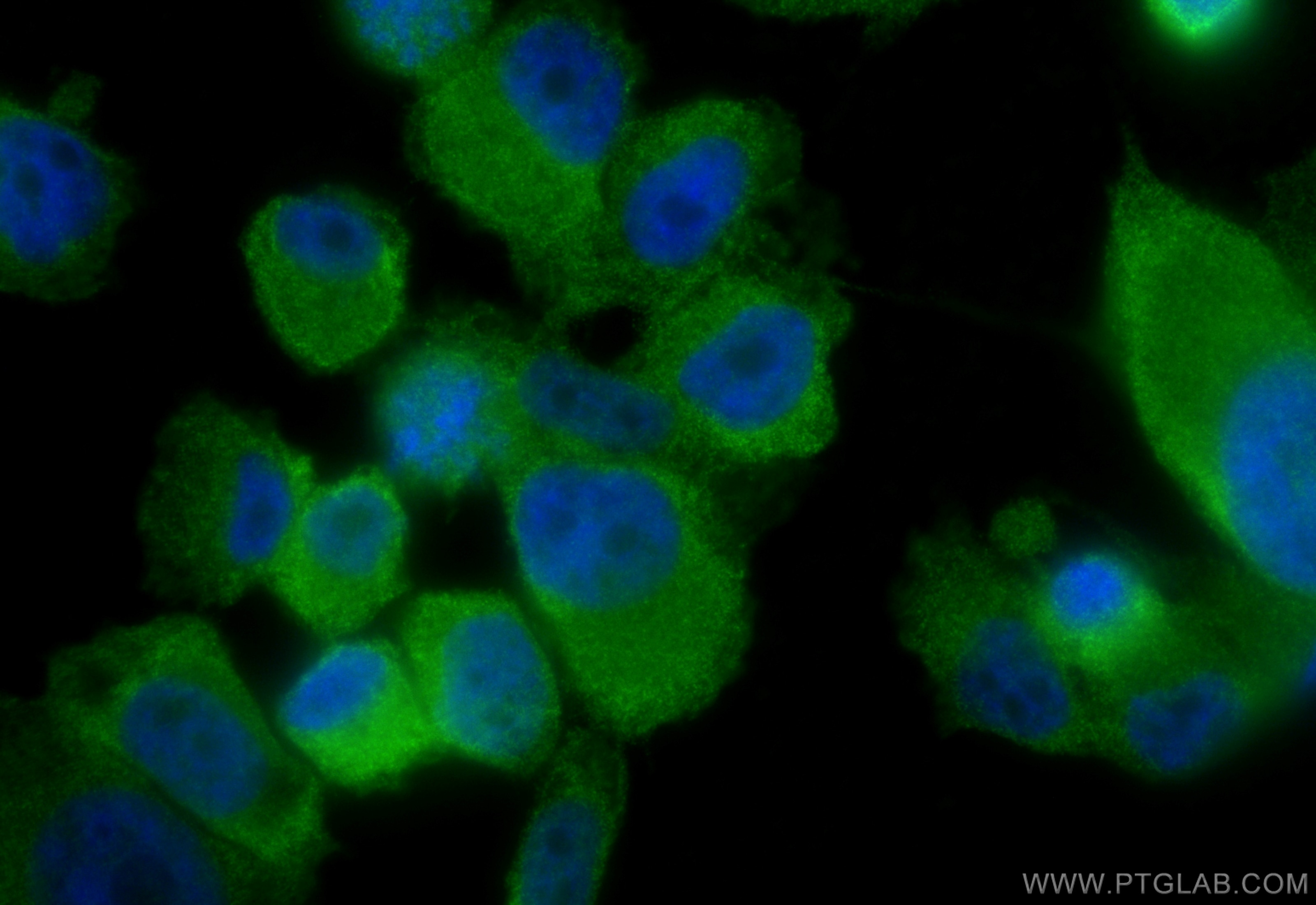 Immunofluorescence (IF) / fluorescent staining of PC-3 cells using PPP2R5A Polyclonal antibody (12675-2-AP)