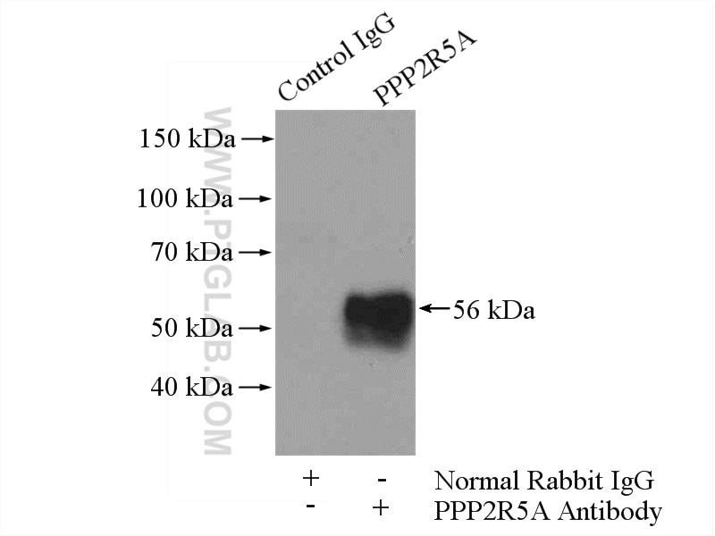 Immunoprecipitation (IP) experiment of mouse brain tissue using PPP2R5A Polyclonal antibody (12675-2-AP)