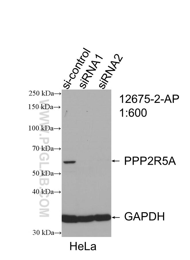 Western Blot (WB) analysis of HeLa cells using PPP2R5A Polyclonal antibody (12675-2-AP)