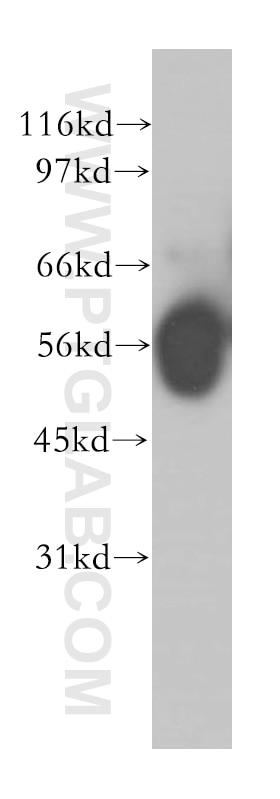 Western Blot (WB) analysis of human ileum tissue using PPP2R5A Polyclonal antibody (12675-2-AP)