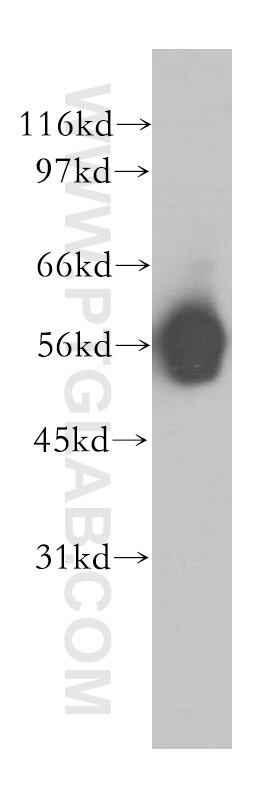 Western Blot (WB) analysis of human heart tissue using PPP2R5A Polyclonal antibody (12675-2-AP)