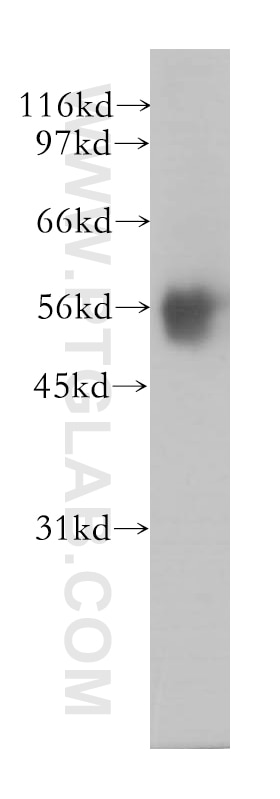 Western Blot (WB) analysis of human kidney tissue using PPP2R5A Polyclonal antibody (12675-2-AP)
