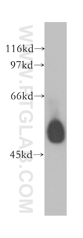 Western Blot (WB) analysis of human lung tissue using PPP2R5A Polyclonal antibody (12675-2-AP)