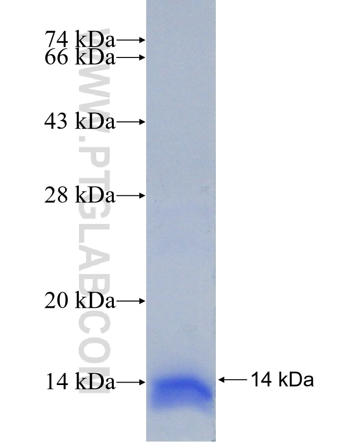 PPP2R5A fusion protein Ag31150 SDS-PAGE PPP2R5A fusion protein Ag31150 SDS-PAGE