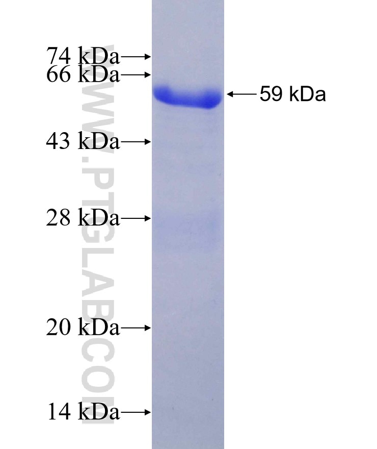 PPP2R5A fusion protein Ag3360 SDS-PAGE