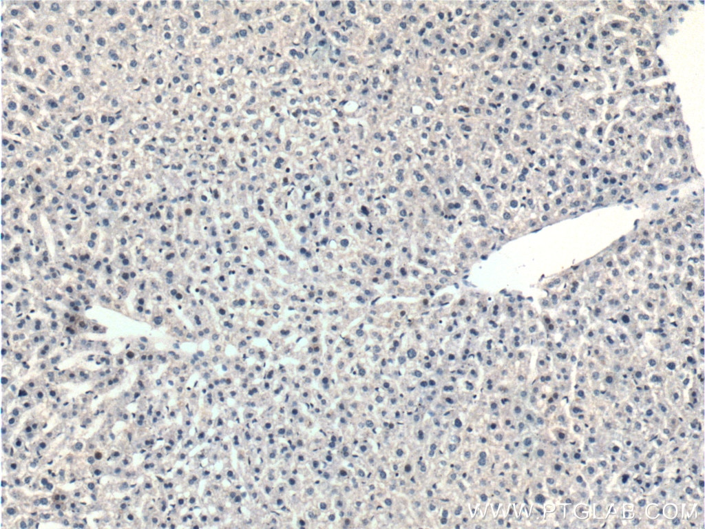 Immunohistochemistry (IHC) staining of mouse liver tissue using PPP2R5C Polyclonal antibody (11276-1-AP)