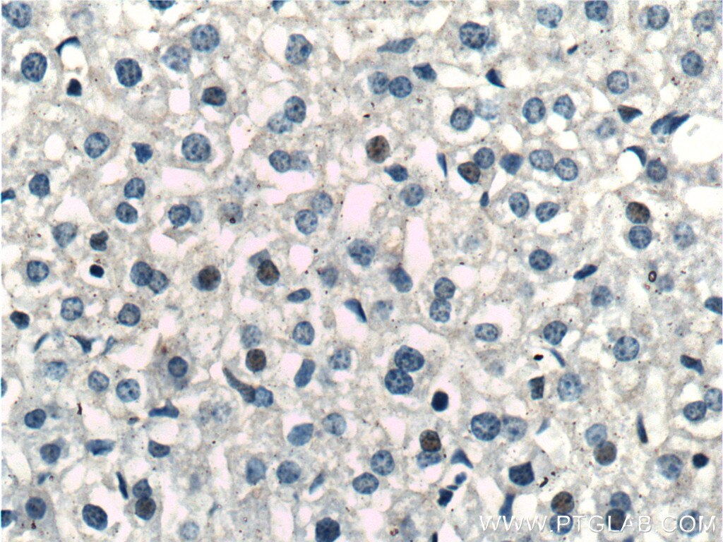 Immunohistochemistry (IHC) staining of mouse liver tissue using PPP2R5C Polyclonal antibody (11276-1-AP)