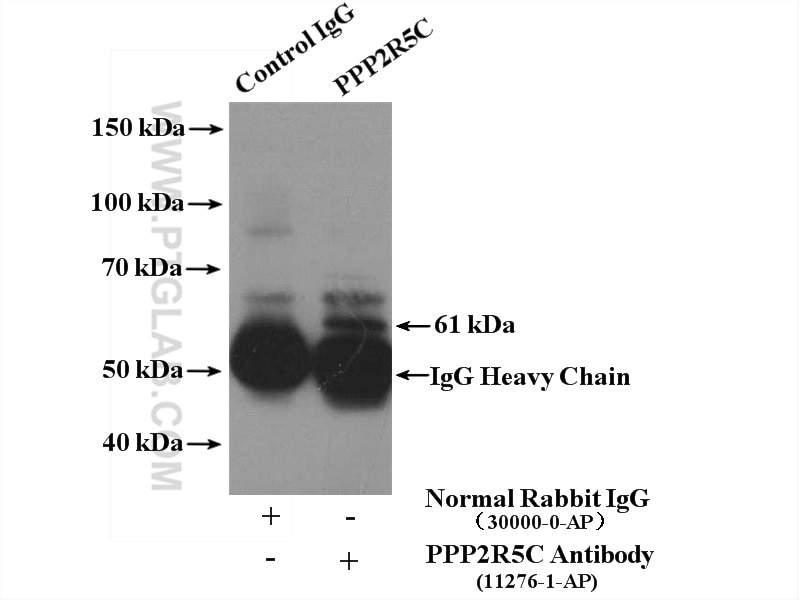 Immunoprecipitation (IP) experiment of mouse brain tissue using PPP2R5C Polyclonal antibody (11276-1-AP)