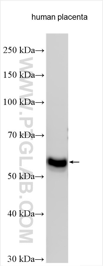 Western Blot (WB) analysis of various lysates using PPP2R5C Polyclonal antibody (11276-1-AP)